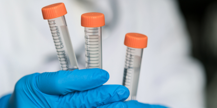 CDC investiga un parásito del estómago en California