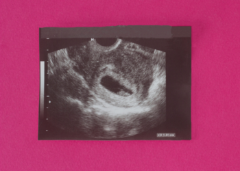 Aborto