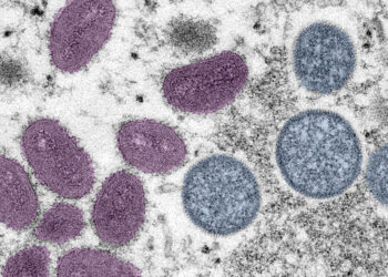 Recomiendan vacunarse contra Viruela del Mono tras registrarse 11 nuevos casos