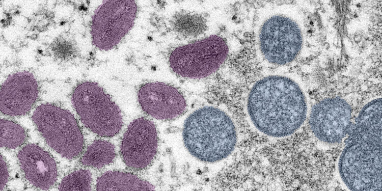 Recomiendan vacunarse contra Viruela del Mono tras registrarse 11 nuevos casos