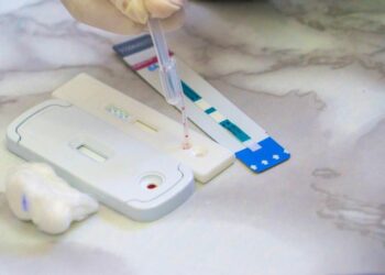 Secretaría de Salud aplicó 30 mil pruebas de SIDA en lo que va del 2023