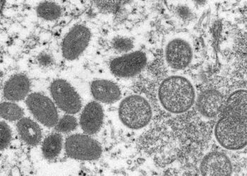 Primer caso de “Viruela del mono” en California