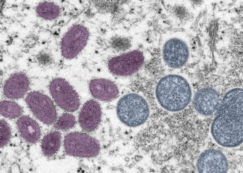 La OMS declara que la viruela del mono no es emergencia de salud mundial