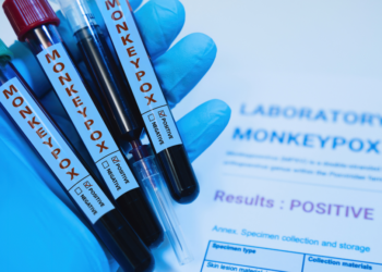 Monkeypox