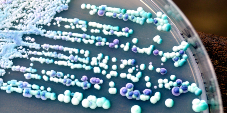 Candida Auris