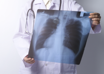 En el Día Mundial de la Tuberculosis más vale prevenir y hacerse una prueba