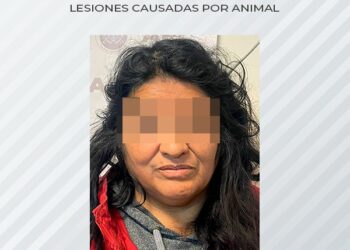 Dueña de Perros arrestada por ataque