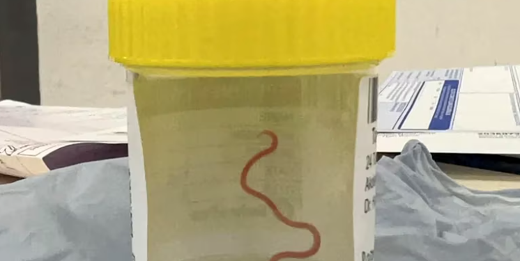 Gusano Vivo AP