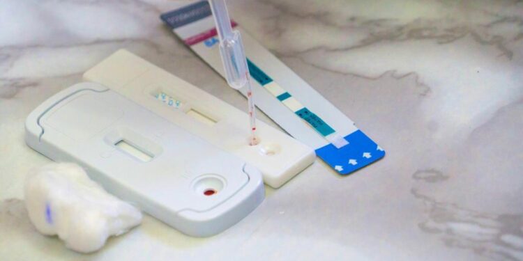 Secretaría de Salud aplicó 30 mil pruebas de SIDA en lo que va del 2023