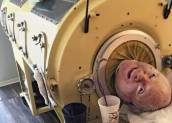 Fallece Paul Alexander después de vivir 70 años en un pulmón de acero