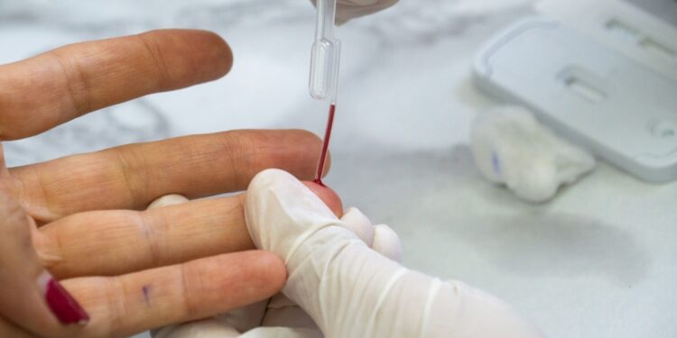 Ofrece secretaría de salud atención integral a pacientes con VIH-Sida