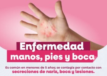 Secretaría de Salud refuerza llamado para prevenir contagios por virus Coxsackie en Baja California