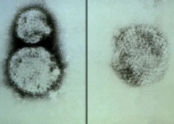 California monitorea a pasajeros de crucero por brote de hantavirus