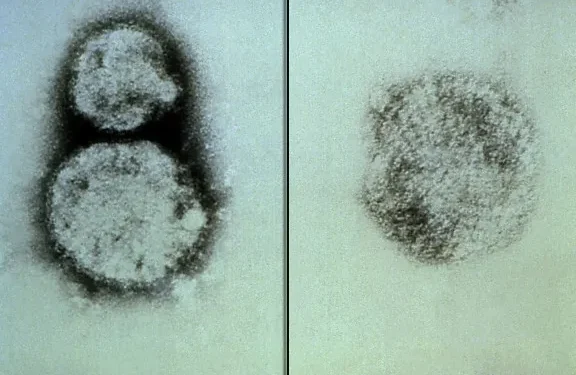 California monitorea a pasajeros de crucero por brote de hantavirus