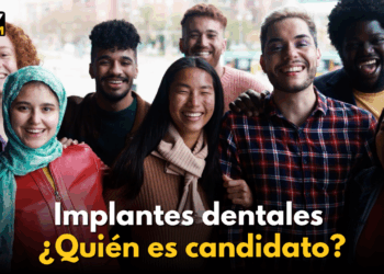 Implantes dentales ¿Quién es candidato? | KSDY AM