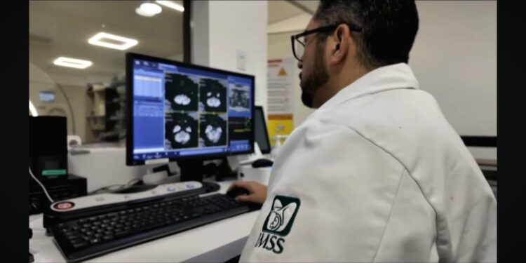 IMSS alerta sobre síntomas neurológicos
