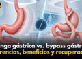 Manga gástrica vs. bypass gástrico: diferencias, beneficios y recuperación | KSDY AM